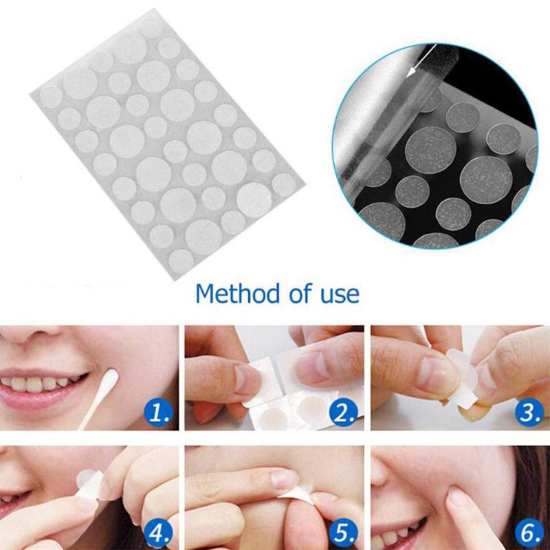 Copy of Skin Tag Removal Treatment Patch 108 PCS